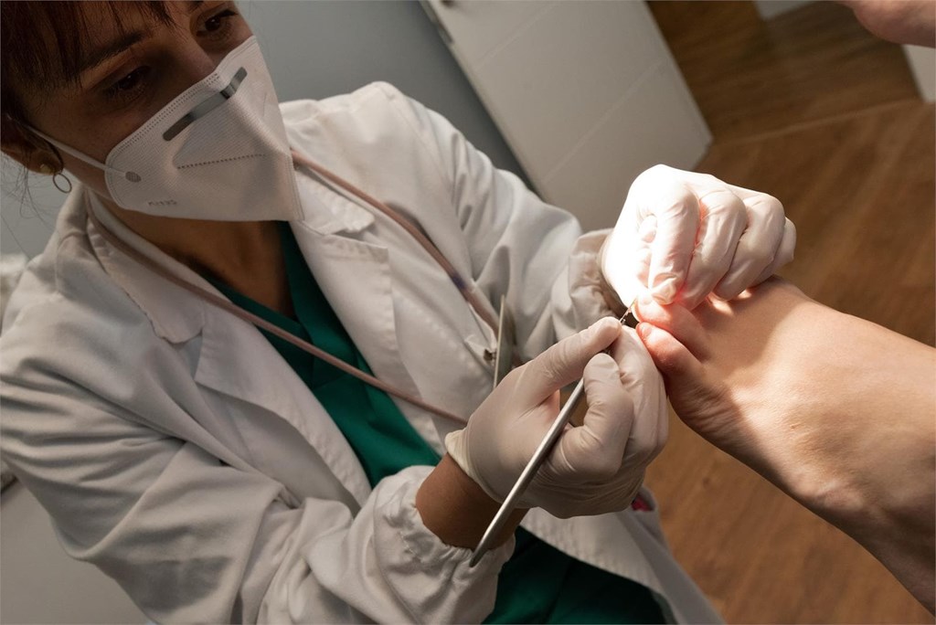 Cirugía ungueal: ¿cuándo es necesaria?