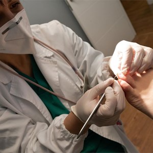 Cirugía ungueal: ¿cuándo es necesaria?