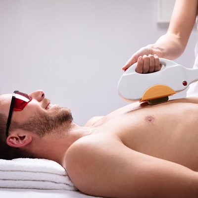 Depilación láser masculina: consejos y recomendaciones