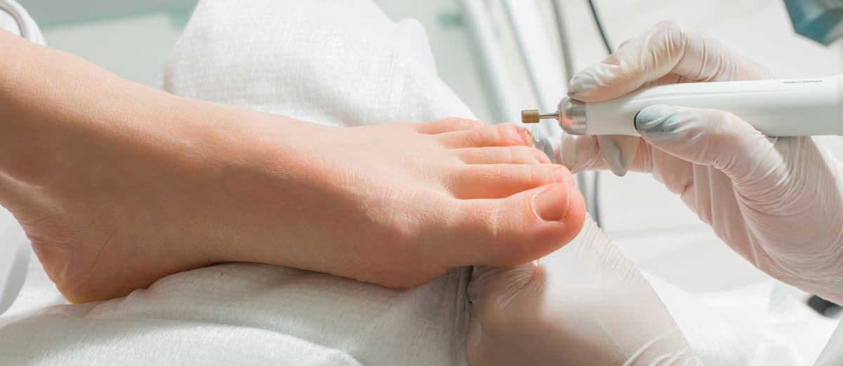 Podología en Arzúa